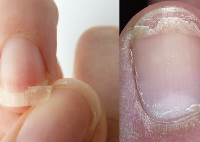 How to Get Strong Nails: Prevent Breaking and Cracking for Good