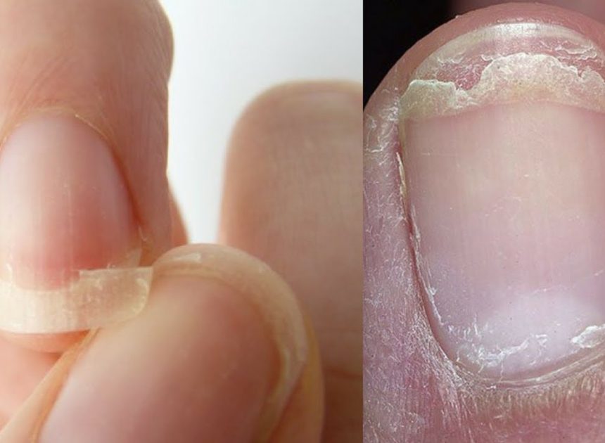 How to Get Strong Nails: Prevent Breaking and Cracking for Good