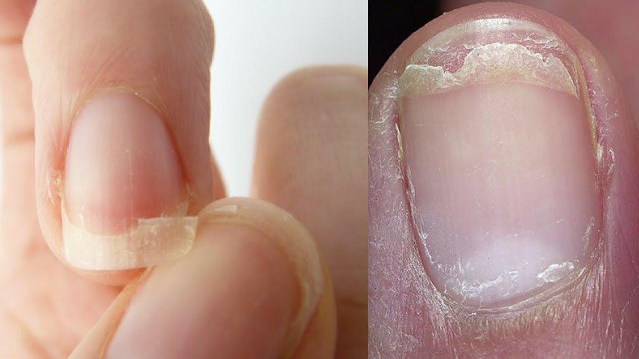How to Get Strong Nails: Prevent Breaking and Cracking for Good